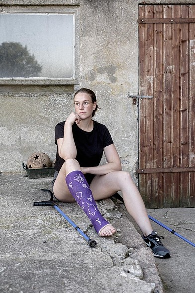Junge Frau mit Unterschenkelgips sitzt auf einem Betonboten vor einer alten Betonwand und schaut nachdenklich zur Seite.