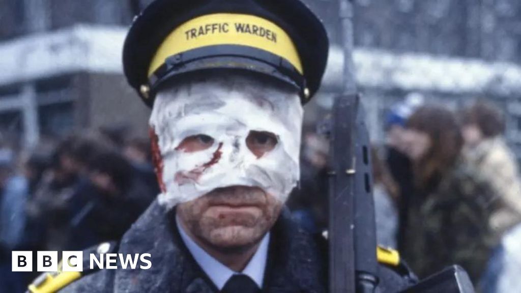 A traffic warden wears a grimy bandage over most of his face, with a rifle slung over his left shoulder in front of people penned in behind wire.