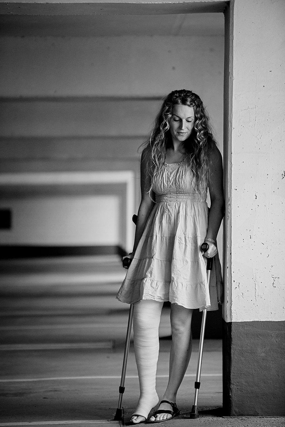 Eine junge Frau mit langen, gewellten Haaren steht in einem überdachten Bereich und stützt sich auf zwei Unterarmgehstützen. Ihr ganzes rechtes Bein ist  mit einem weißen Gipsverband versehen. Sie trägt ein ärmelloses, knielanges Sommerkleid und offene Sandalen. Ihr Blick ist nach unten gerichtet, und sie lehnt leicht an einer Wand.